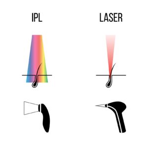 IPL vs Laser Hair Removal Procedures