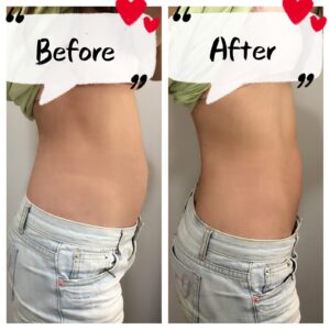Slimming Results of Calista, mummy influencer