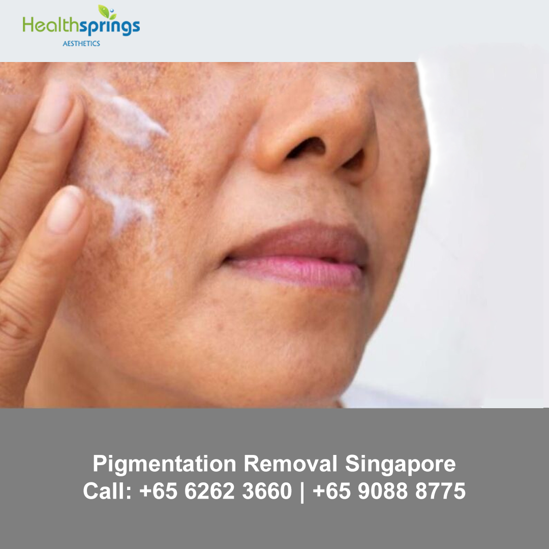 Pigmentation Treatment Singapore